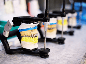 Dental lab success story
